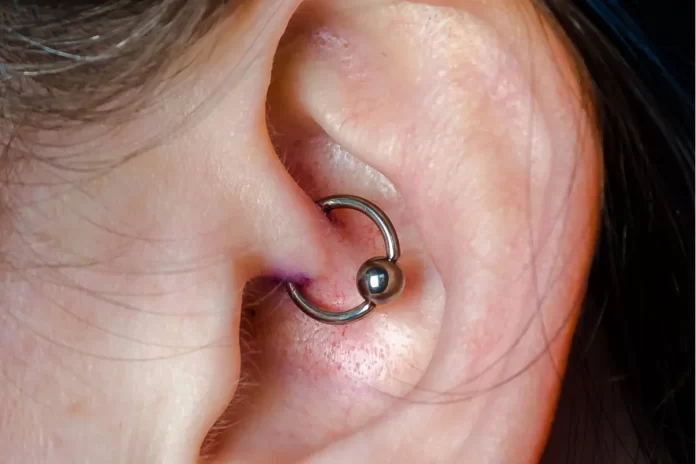 Por qué no se cura un piercing-Miami news 24