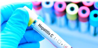 Argentina registra primer caso de hepatitis aguda grave desconocida