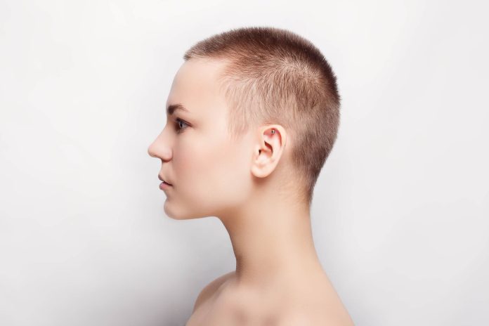 ¡Gran logro para la salud! la primera pastilla para combatir la alopecia es aprobada por la FDA-MiamiNews24