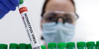 Preocupación en Florida por aumento de viruela del mono, conoce dónde puedes vacunarte