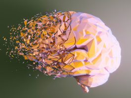 enfermedad alzheimer aumentar 2030-miaminews24