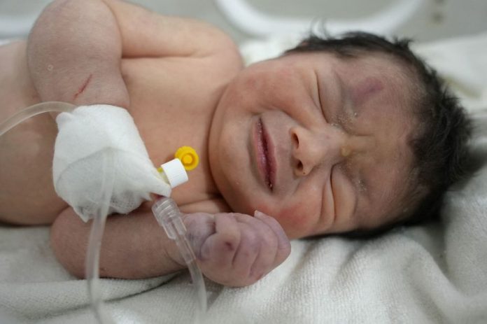 terremoto Turquía bebé milagro-miaminews24