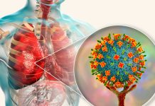 Virus Nipah: La amenaza invisible que acecha en las sombras del sudeste asiático