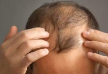 El fin de la calvicie: Células madre logran un éxito del 100% en la regeneración capilar